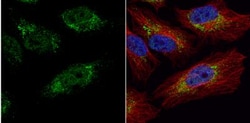 PGK1 Antibody, Novus Biologicals 0.1mL; Unlabeled:Antibodies, Polyclonal