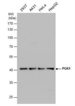 PGK1 Antibody, Novus Biologicals 0.1mL; Unlabeled:Antibodies, Polyclonal
