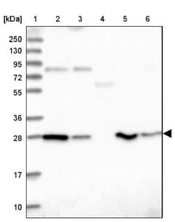 PGLS Antibody, Novus Biologicals 0.1mL; Unlabeled:Antibodies, Polyclonal
