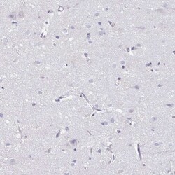 PGLYRP1/PGRP-S Antibody, Novus Biologicals 25 &mu;L | Buy Online | Novus Biologicals | Fisher Scientific