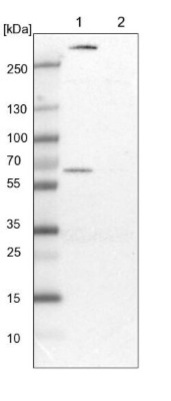 PGM1 Antibody, Novus Biologicals 0.1mL; Unlabeled:Antibodies, Polyclonal