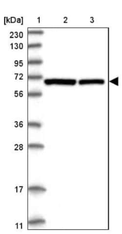 PGM3 Antibody, Novus Biologicals 25 &mu;L; Unlabeled:Antibodies, Polyclonal