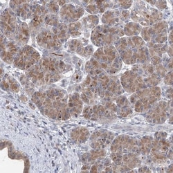PGR1 Antibody, Novus Biologicals 0.1mL; Unlabeled:Antibodies, Polyclonal