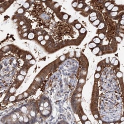 PGR1 Antibody, Novus Biologicals 0.1mL; Unlabeled:Antibodies, Polyclonal
