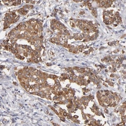 PGRMC1 Antibody, Novus Biologicals 25 &mu;L; Unlabeled:Antibodies, Polyclonal