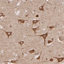 PGRMC1 Antibody, Novus Biologicals 25 &mu;L; Unlabeled:Antibodies, Polyclonal