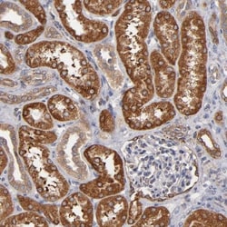 PGRMC1 Antibody, Novus Biologicals 25 &mu;L; Unlabeled:Antibodies, Polyclonal
