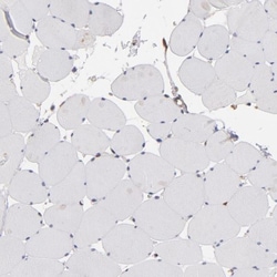 PGRMC1 Antibody, Novus Biologicals 25 &mu;L; Unlabeled:Antibodies, Polyclonal