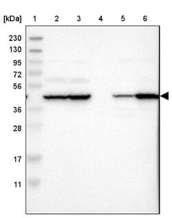 PHACS Antibody, Novus Biologicals:Antibodies:Primary Antibodies