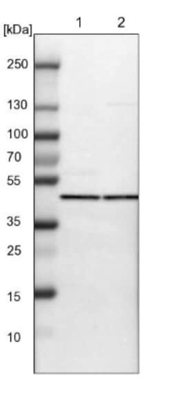 PHACS Antibody, Novus Biologicals:Antibodies:Primary Antibodies