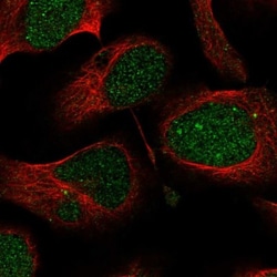 PHF1 Antibody, Novus Biologicals 0.1mL; Unlabeled:Antibodies, Polyclonal