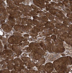 PHF1 Antibody, Novus Biologicals 0.1mL; Unlabeled:Antibodies, Polyclonal