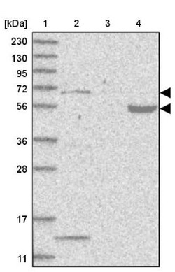 PHF1 Antibody, Novus Biologicals 0.1mL; Unlabeled:Antibodies, Polyclonal