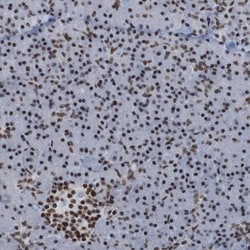 PHF2 Antibody, Novus Biologicals 0.1mL; Unlabeled:Antibodies, Polyclonal