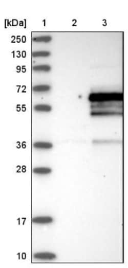 PHF22 Antibody, Novus Biologicals 0.1mL; Unlabeled:Antibodies, Polyclonal