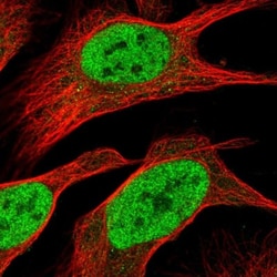 PHF23 Antibody, Novus Biologicals 0.1mL; Unlabeled:Antibodies, Polyclonal