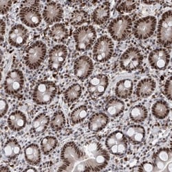 PHF5A Antibody, Novus Biologicals 25 &mu;L; Unlabeled:Antibodies, Polyclonal