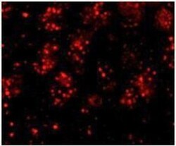 PHF6 Antibody, Novus Biologicals 0.1 mL | Buy Online | Novus Biologicals | Fisher Scientific