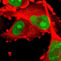 PHF6 Antibody, Novus Biologicals 0.1mL; Unlabeled:Antibodies, Polyclonal