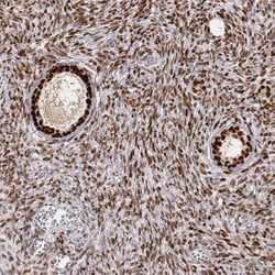 PHF6 Antibody, Novus Biologicals 0.1mL; Unlabeled:Antibodies, Polyclonal
