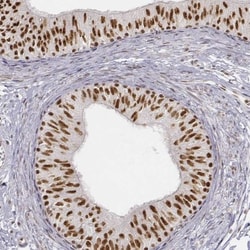 PHF6 Antibody, Novus Biologicals 0.1mL; Unlabeled:Antibodies, Polyclonal