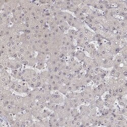 PHF6 Antibody, Novus Biologicals 0.1mL; Unlabeled:Antibodies, Polyclonal