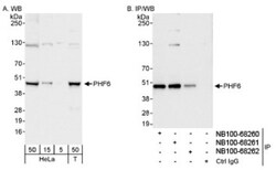PHF6 Antibody, Novus Biologicals 0.1 mL | Buy Online | Novus Biologicals | Fisher Scientific