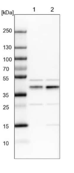 PHF6 Antibody, Novus Biologicals 0.1mL; Unlabeled:Antibodies, Polyclonal