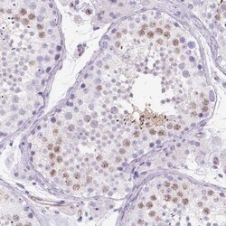 PHF7 Antibody, Novus Biologicals:Antibodies:Primary Antibodies