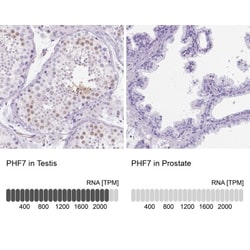 PHF7 Antibody, Novus Biologicals:Antibodies:Primary Antibodies
