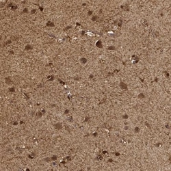 PHGDH Antibody, Novus Biologicals:Antibodies:Primary Antibodies