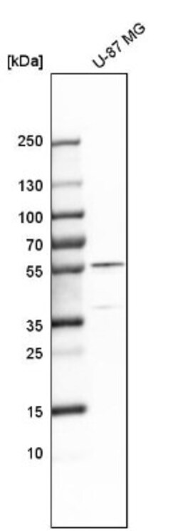 PHGDH Antibody, Novus Biologicals:Antibodies:Primary Antibodies