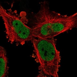 PHIP Antibody, Novus Biologicals 0.1mL; Unlabeled:Antibodies, Polyclonal