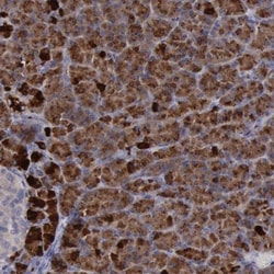 PHKA1 Antibody, Novus Biologicals 0.1mL; Unlabeled:Antibodies, Polyclonal