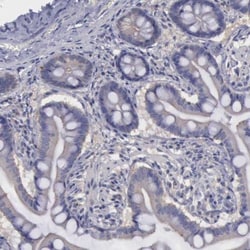 PHKA1 Antibody, Novus Biologicals 0.1mL; Unlabeled:Antibodies, Polyclonal