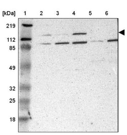 PHKA1 Antibody, Novus Biologicals 0.1mL; Unlabeled:Antibodies, Polyclonal