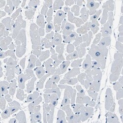 PHKG1 Antibody, Novus Biologicals 25 &mu;L; Unlabeled:Antibodies, Polyclonal
