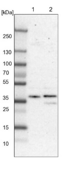 PHKG1 Antibody, Novus Biologicals 25 &mu;L; Unlabeled:Antibodies, Polyclonal