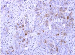 PHOSPHO1 Antibody, Novus Biologicals 0.1mL; Unlabeled:Antibodies, Polyclonal