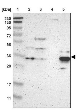 PHYH Antibody, Novus Biologicals:Antibodies:Primary Antibodies
