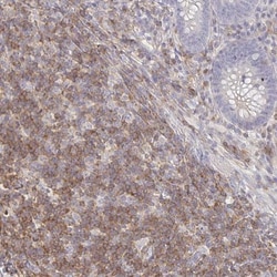 PI 3-Kinase p110 delta Antibody, Novus Biologicals 0.1mL; Unlabeled:Antibodies,