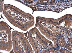 PI 3-Kinase p85 alpha Antibody, Novus Biologicals 0.1mL; Unlabeled:Antibodies,