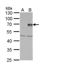 PIASy Antibody, Novus Biologicals 0.1mg; Unlabeled:Antibodies, Polyclonal