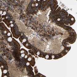 PICALM Antibody, Novus Biologicals 0.1mL; Unlabeled:Antibodies, Polyclonal