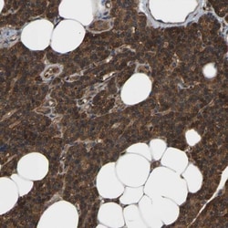 PICALM Antibody, Novus Biologicals 0.1mL; Unlabeled:Antibodies, Polyclonal