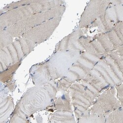 PICALM Antibody, Novus Biologicals 0.1mL; Unlabeled:Antibodies, Polyclonal