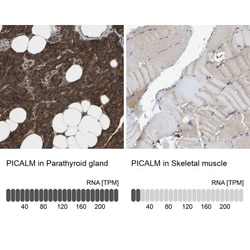 PICALM Antibody, Novus Biologicals 0.1mL; Unlabeled:Antibodies, Polyclonal