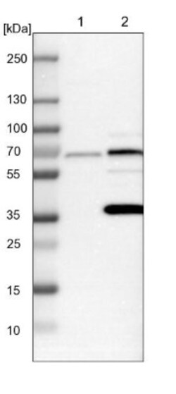 PICALM Antibody, Novus Biologicals 0.1mL; Unlabeled:Antibodies, Polyclonal