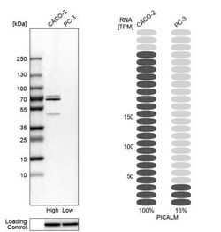 PICALM Antibody, Novus Biologicals 0.1mL; Unlabeled:Antibodies, Polyclonal