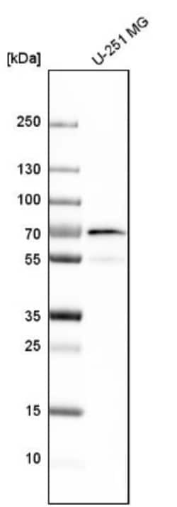 PICALM Antibody, Novus Biologicals 0.1mL; Unlabeled:Antibodies, Polyclonal